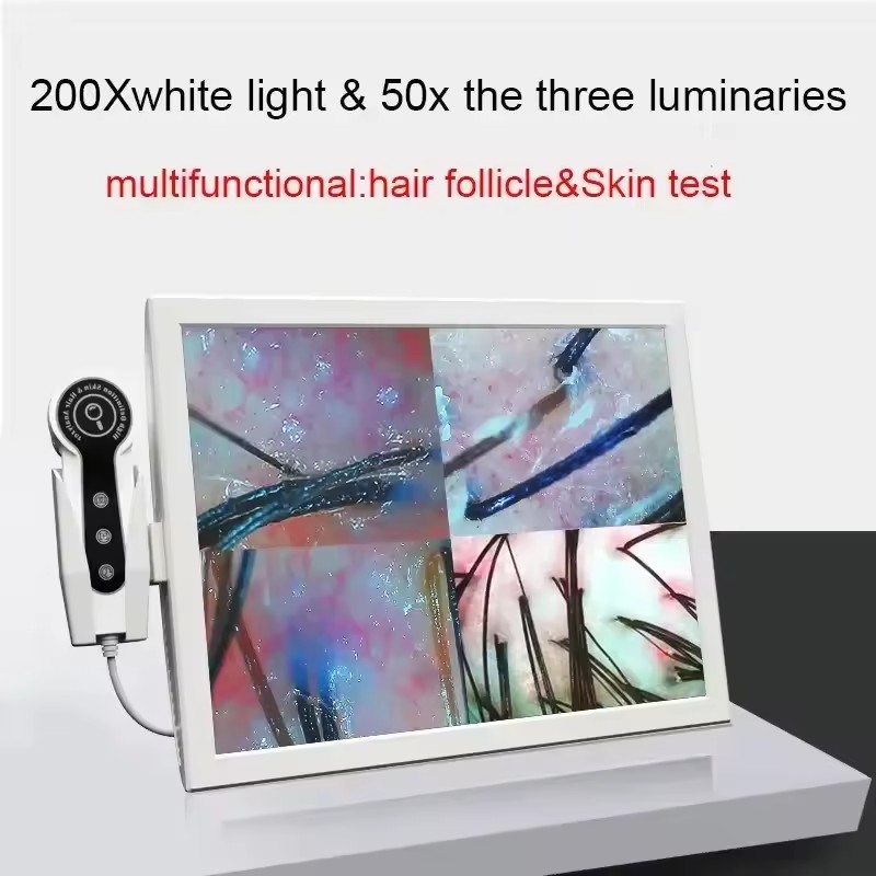 Skin Moisture Analyzer Digital Detector - Analizzatore digitale HD della pelle Rilevatore