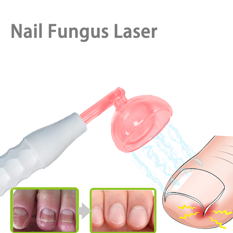 High Frequency Wand Facial Machine Neon - Dispositivo per Elettroterapia Facciale ad Alta