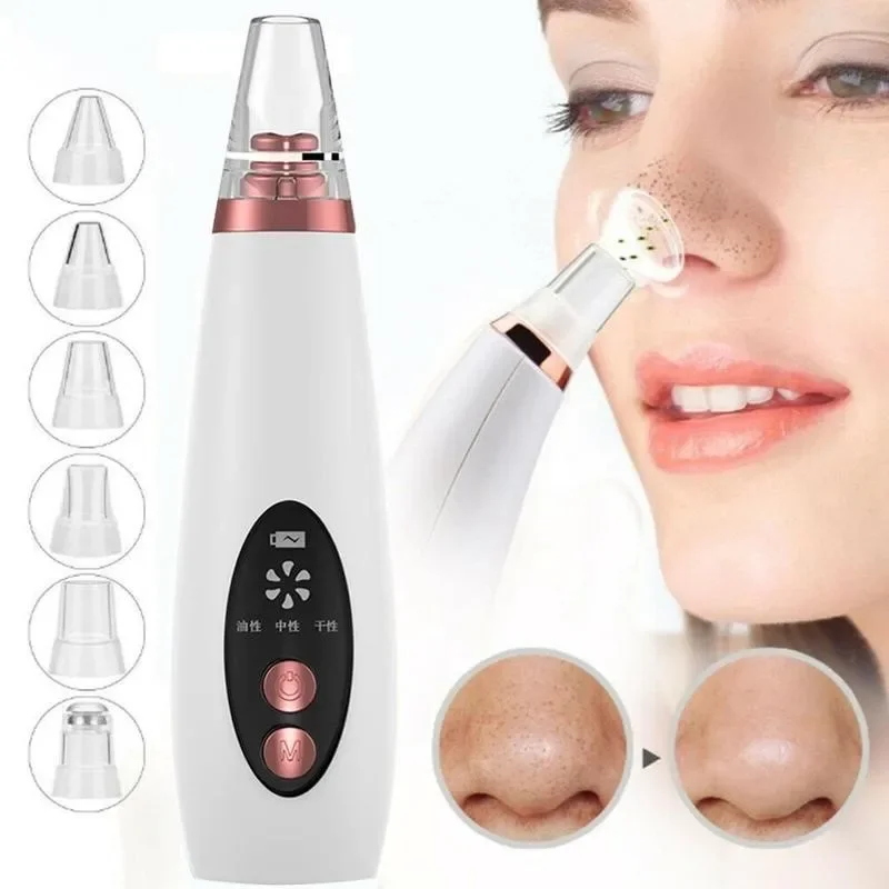 Blackhead Remover Vacuum Suction - Aspiratore per Punti Neri Elettrico, Pulitore