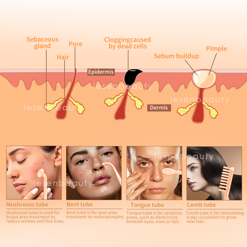 Nuovo Dispositivo Facciale ad  - High Frequency Wand Facial Machine Neon recensione e prezzo