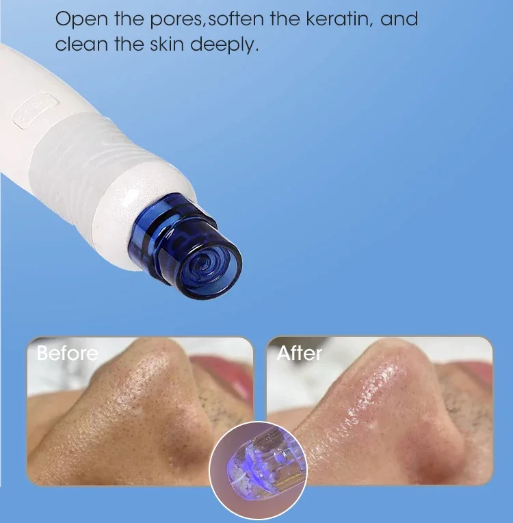 Spa di vendita caldo utilizza  - Hydro Facial Machine 7 In 1 recensione e prezzo