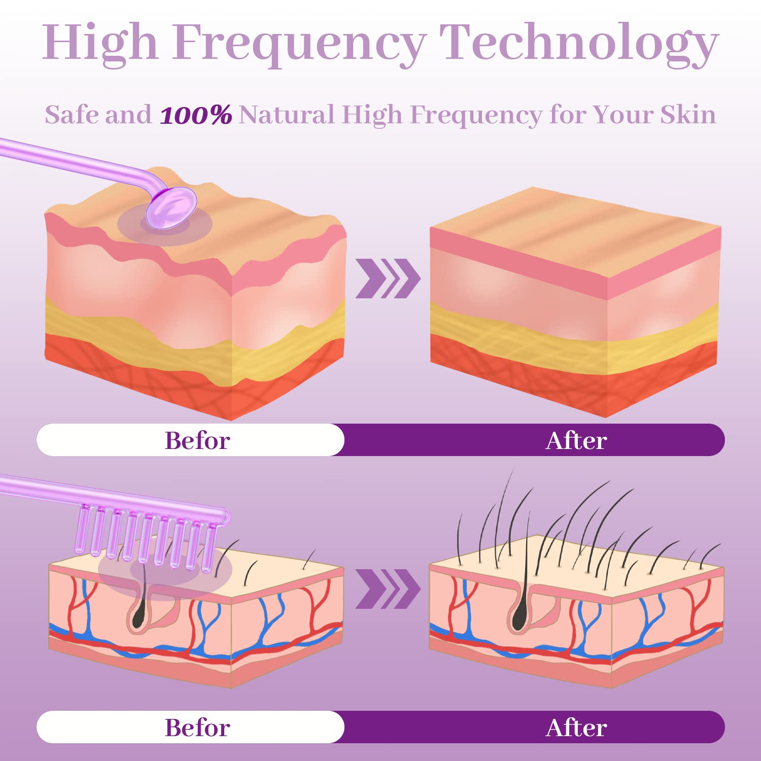 Bacchetta elettrodo ad alta fr - High Frequency Wand Facial Machine Neon recensione e prezzo