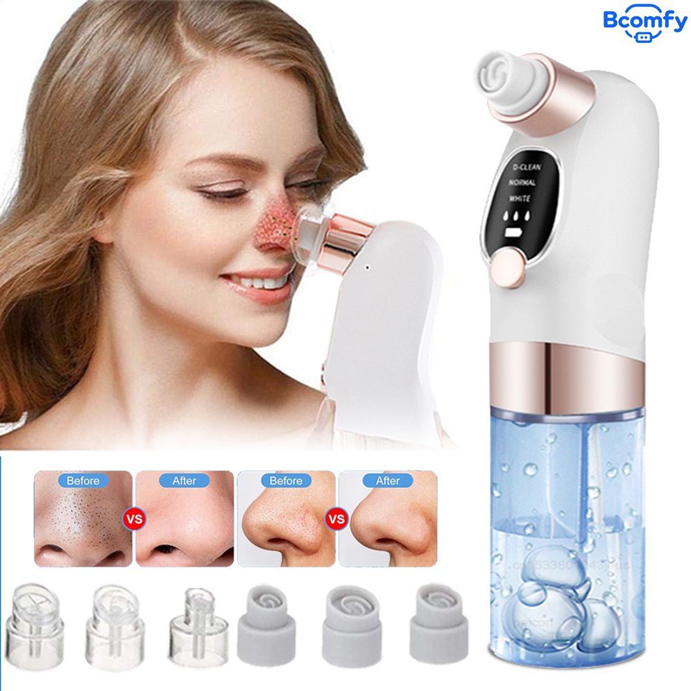 Aspirapolvere elettrico per la - Blackhead Remover Vacuum Suction recensione e prezzo