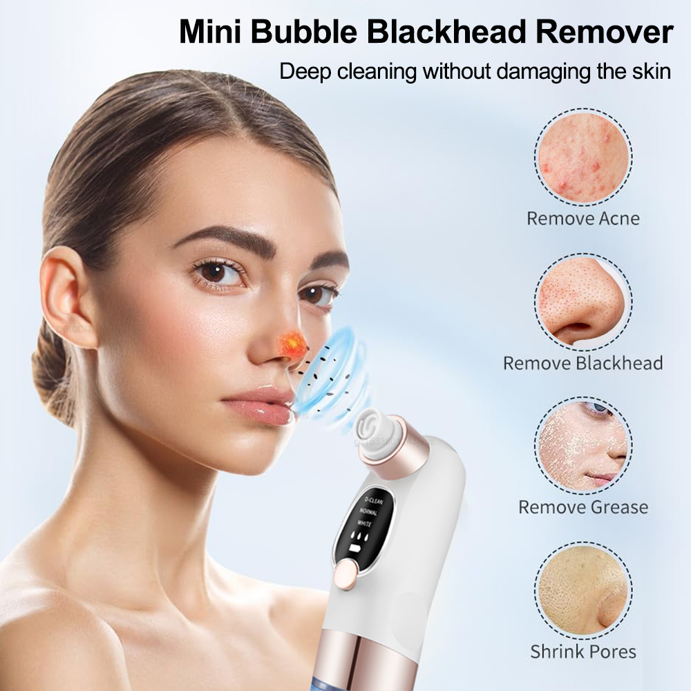 Aspirapolvere elettrico per la - Blackhead Remover Vacuum Suction recensione e prezzo