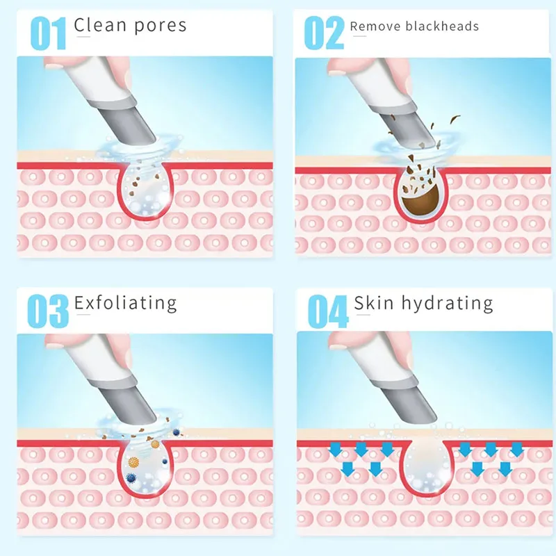 NUOVO Dispositivo di Peeling B - Hydra Dermabrasion Aqua Peel Machine recensione e prezzo