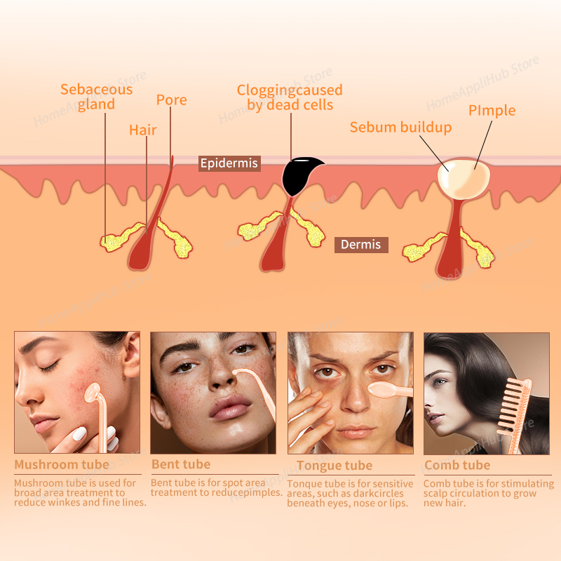 Darsonval Terapia portatile pe - High Frequency Wand Facial Machine Neon recensione e prezzo