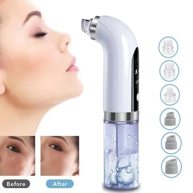 Dispositivo portatile per la p - Blackhead Remover Vacuum Suction recensione e prezzo