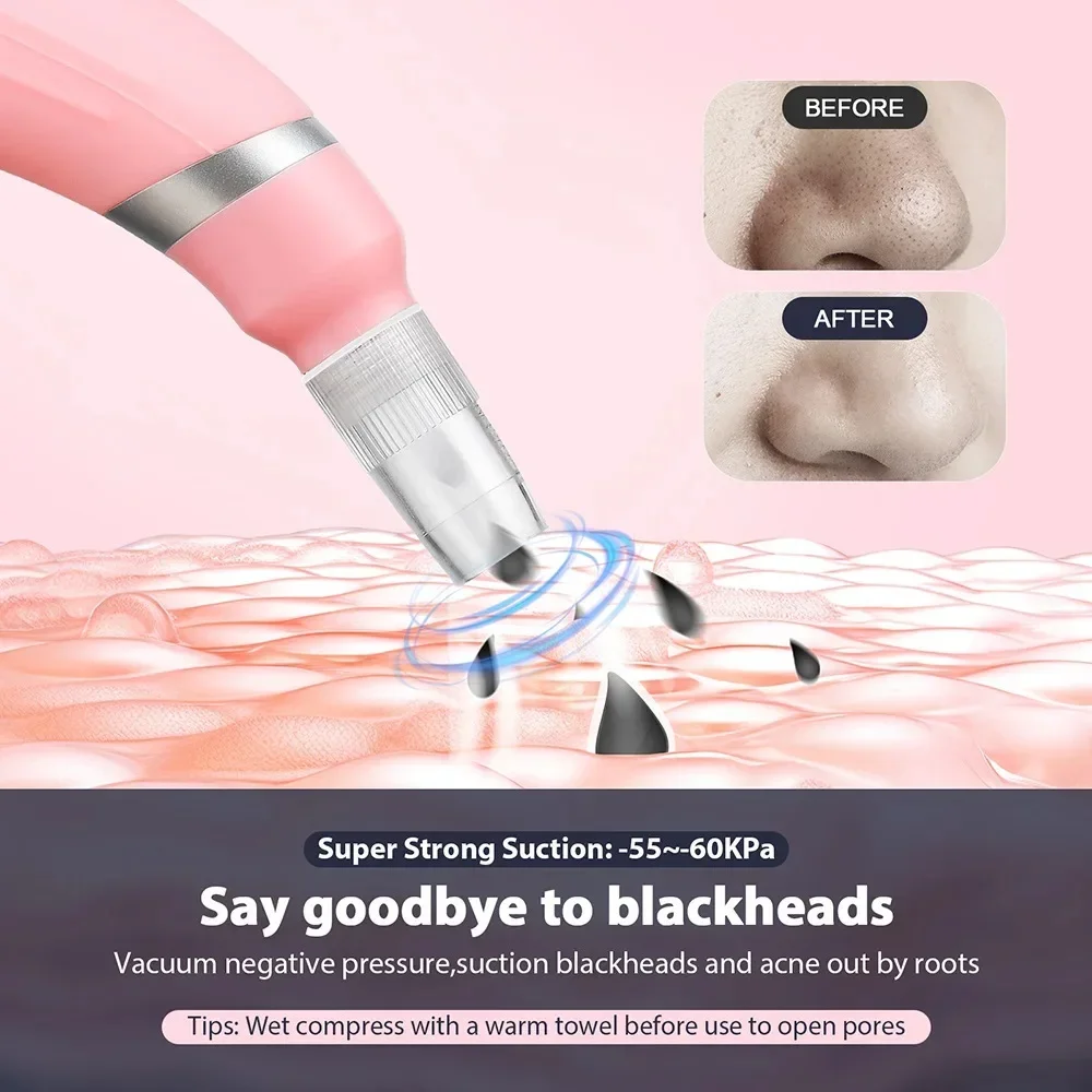 Macchina per Microdermoabrasio - Diamond Microdermabrasion Machine 3 In 1 recensione e prezzo