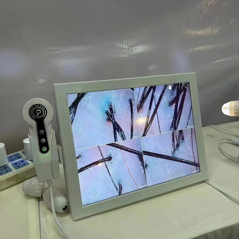 Analizzatore Digitale HD della - Skin Moisture Analyzer Digital Detector recensione e prezzo
