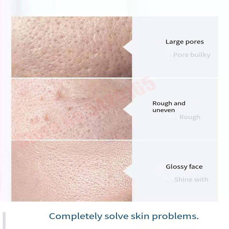 Hydra Siero Soluzione Viso Pul - Hydra Dermabrasion Aqua Peel Machine recensione e prezzo