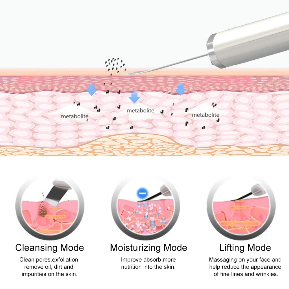 Scrubber per la pelle ad ultra - Blackhead Remover Vacuum Suction recensione e prezzo