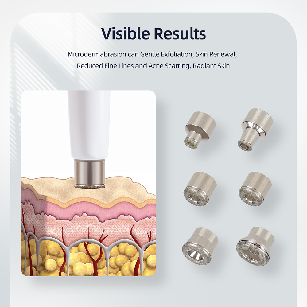 Macchina 3-in-1 per Microdermo - Diamond Microdermabrasion Machine 3 In 1 recensione e prezzo