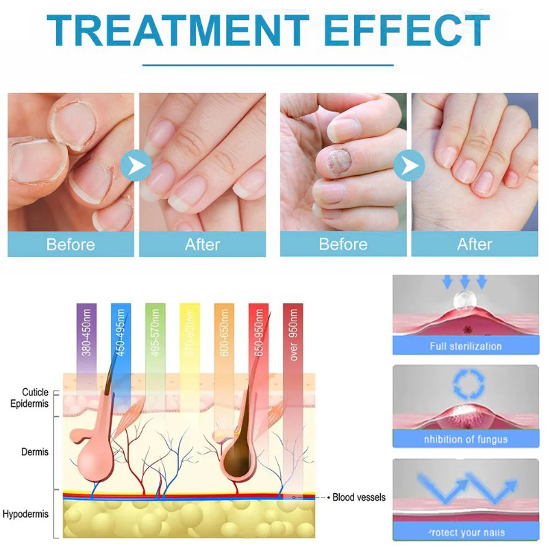 Dispositivo per Elettroterapia - High Frequency Wand Facial Machine Neon recensione e prezzo