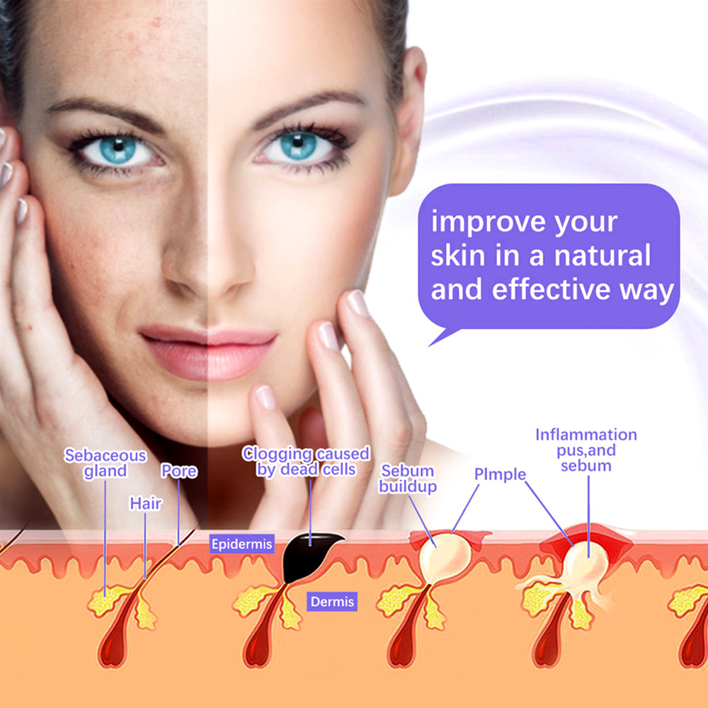 7 in 1 macchina per la cura de - High Frequency Wand Facial Machine Neon recensione e prezzo